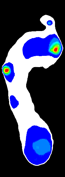 Plantar Pressure Original